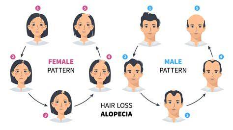 Patrón de miniaturización folicular en alopecia androgenética